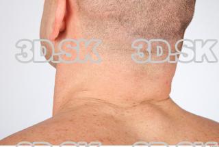 Neck texture of Dale 0003